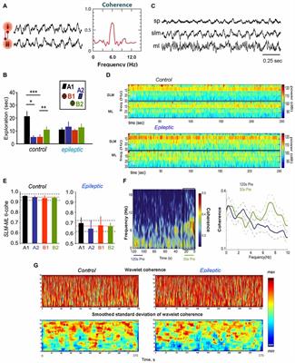 Alterations of Coherent Theta and Gamma Network Oscillations as an Early Biomarker of Temporal Lobe Epilepsy and Alzheimer’s Disease